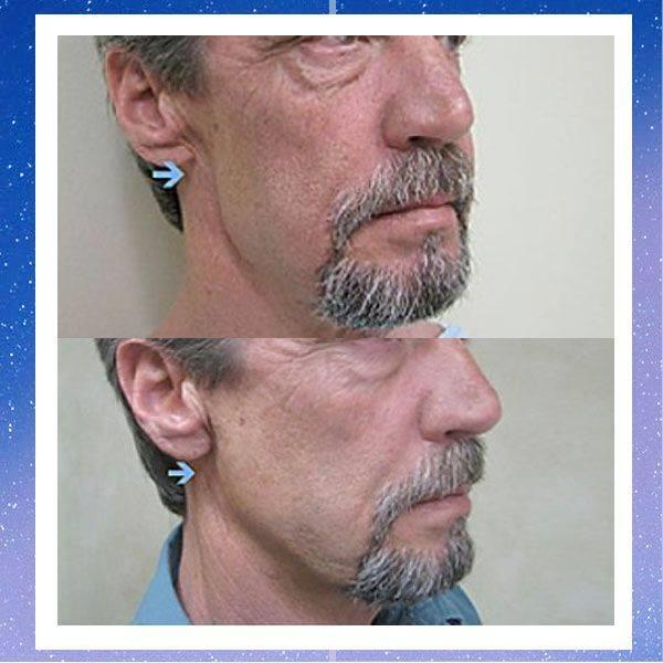 Testimoni Dr Nathan Newman Luminesce 2