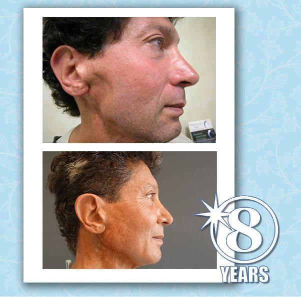 Testimoni Dr Nathan Newman Luminesce 5